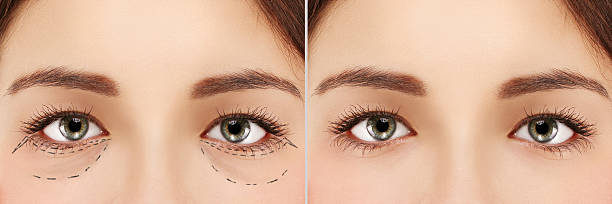 Before and after image showing makeup application technique on hooded eyelids or monolids.